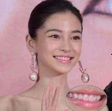 牙齿黑的明星,揭秘牙齿变黑背后的真相